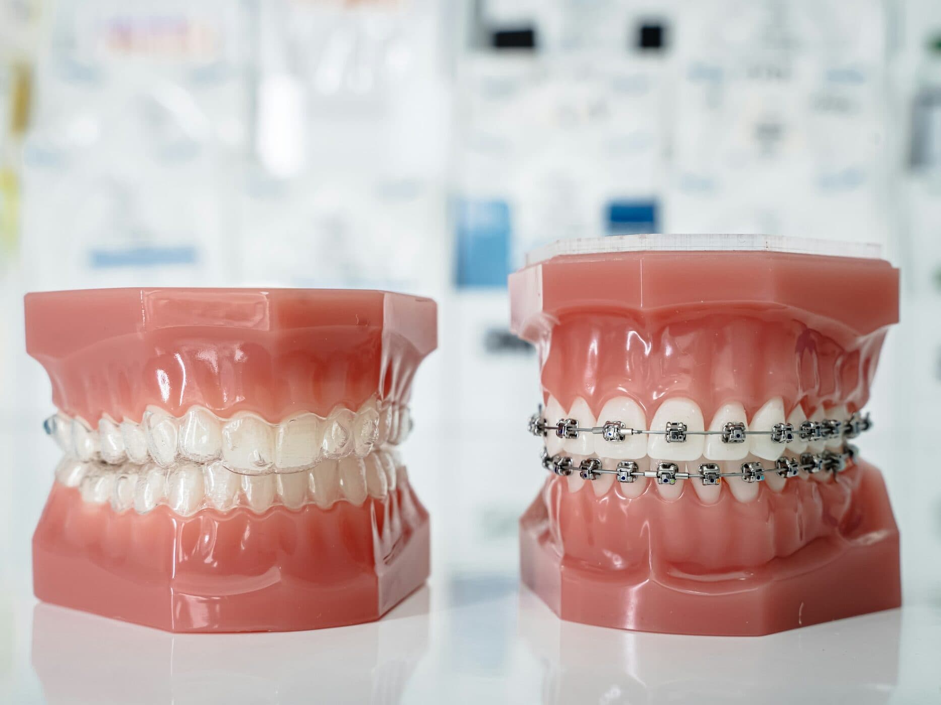 Neuromuscular Orthodontics