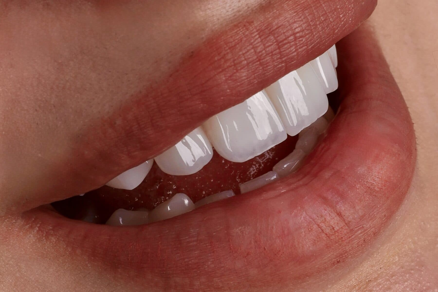 Cosmetic Dentistry